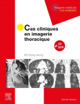 Cas cliniques en imagerie thoracique vignette
